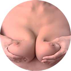 インスピレーションシリーズ – ゼリー型乳房/ソフトな乳房(無料)
